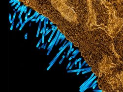 Foto Mikroskopis Bermacam Virus dan Bakteri