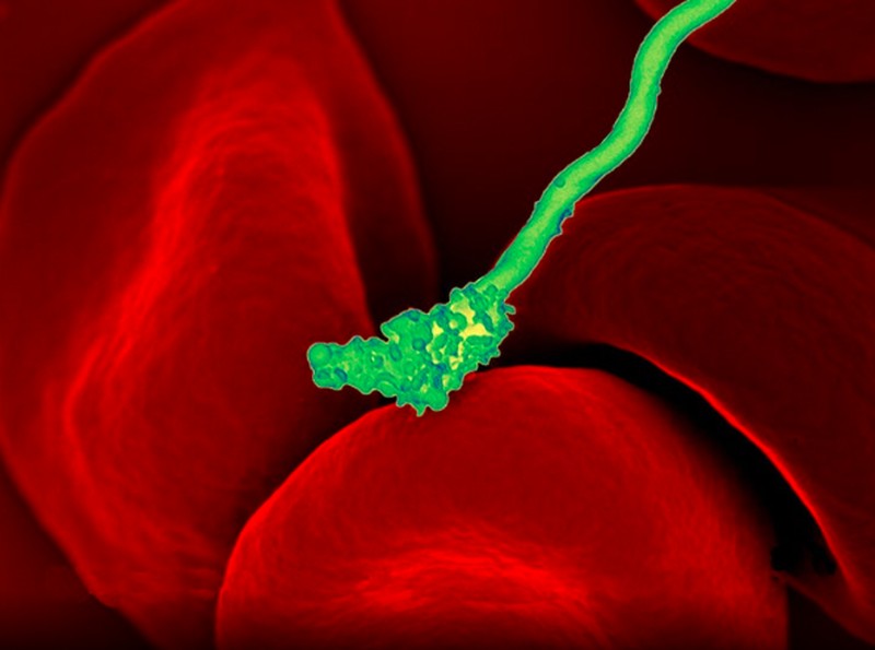 virus dan bakteri