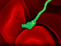 Foto Mikroskopis Bermacam Virus dan Bakteri