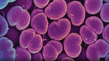 Mikrograf berwarna dari bakteri Neisseria gonorrhoeae, penyebab penyakit kelamin gonore. Foto: NIAID via Weather.com