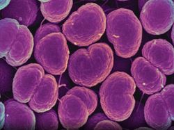 Foto Mikroskopis Bermacam Virus dan Bakteri