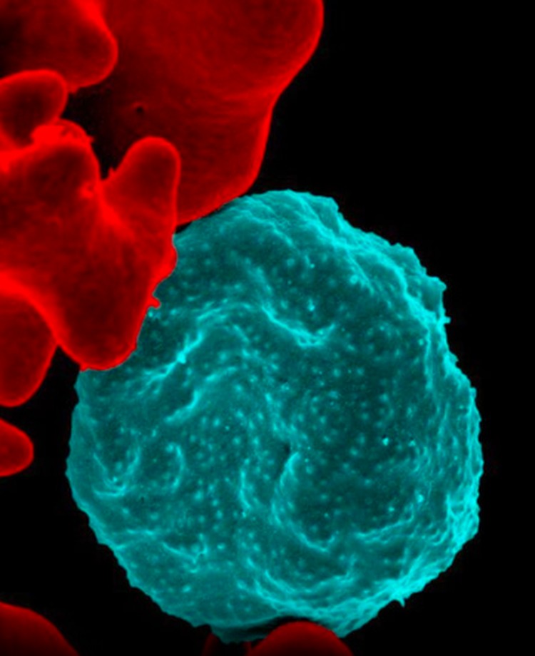 virus dan bakteri virus dan bakteri