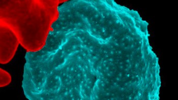 Sel darah merah yang terinfeksi parasit malaria. Sel yang terinfeksi berada di tengah area gambar. Di bagian kiri adalah sel yang tidak terinfeksi dengan warna permukaan merah halus. Foto: NIAID via Weather.com