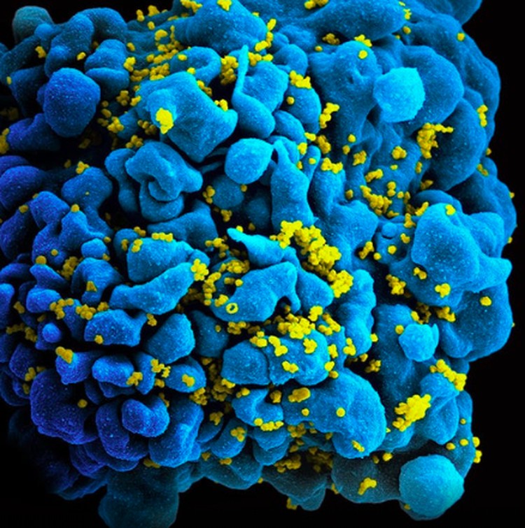 virus dan bakteri virus dan bakteri