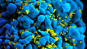 HIV, virus yang menyebabkan AIDS. Pada gambar ini adalah sel T yang terinfeksi HIV. Foto: NIAID via Weather.com