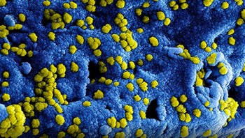 Mikrograf partikel virus corona Middle East Respiratory Syndrome (MERS) yang melekat pada permukaan sel VERO E6 yang terinfeksi. Foto: NIAID via Weather.com