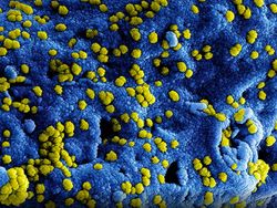 Foto Mikroskopis Bermacam Virus dan Bakteri