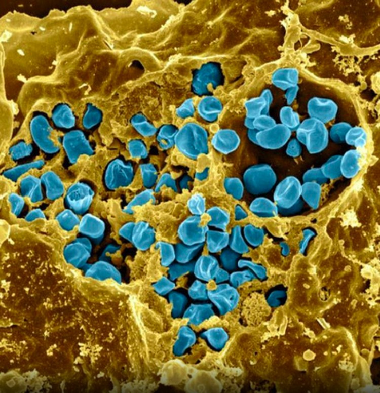 virus dan bakteri virus dan bakteri