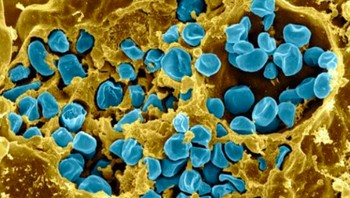 Makrofag yang terinfeksi bakteri Francisella Tularensis. Bakteri (biru) terletak di sitosol atau di dalam vakuola yang terikat membran. Foto: NIAID via Weather.com