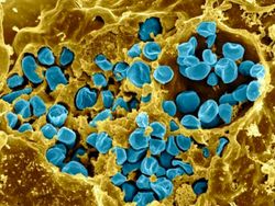 Foto Mikroskopis Bermacam Virus dan Bakteri