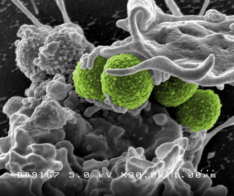virus dan bakteri virus dan bakteri