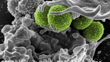 Interaksi MRSA (bakteri berwarna hijau) dengan sel putih manusia. Bakteri yang terlihat pada gambar ini adalah strain MRSA252, penyebab utama infeksi yang sering terjadi di Amerika Serikat dan Inggris. Foto: NIAID via Weather.com
