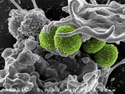 Foto Mikroskopis Bermacam Virus dan Bakteri