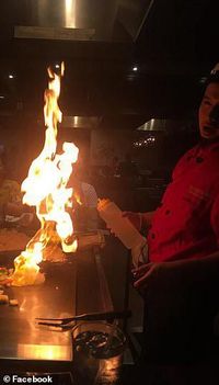 Duh! Wajah Wanita Ini Terbakar Gara-gara Kena Api Teppanyaki