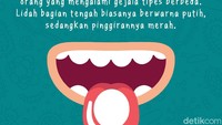 Jika umumnya berwarna merah, tapi pada orang yang mengalami gejala tipes berbeda. Lidah bagian tengah biasanya berwarna putih, sedangkan pinggirannya merah.