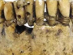 Foto Bersejarah yang Belum Pernah Kamu Lihat Pas Zaman Sekolah