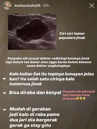 Ada Benjolan Di Payudara Kesha Ratuliu, Kenali Bedanya Kista Dan Tumor