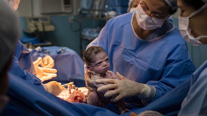 Foto Bayi Viral Foto bayi viral di Brasil