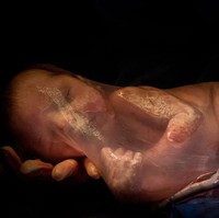 Foto dramatis karya Danila Justus yang memotret sang jabang bayi saat masih terbungkus kantong ketuban. Sebuah peristiwa langka yang jarang terjadi. Foto: Dok. Bored Panda/ International Association of Professional Birth Photographers