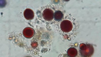 Ini penampakannya dari jarak sangat dekat. Tumbuhan tersebut berkembang di air dingin. Pada saat musim dingin, mereka dalam keadaan tidak aktif. Kemudian saat musim panas, mereka merekah dan menyebarkan spora berwarna merah.Foto: Kementerian Riset Ukraina