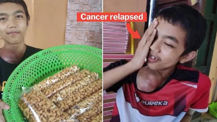jual kacang untuk berobat kanker
