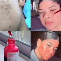 skincare di tiktok
