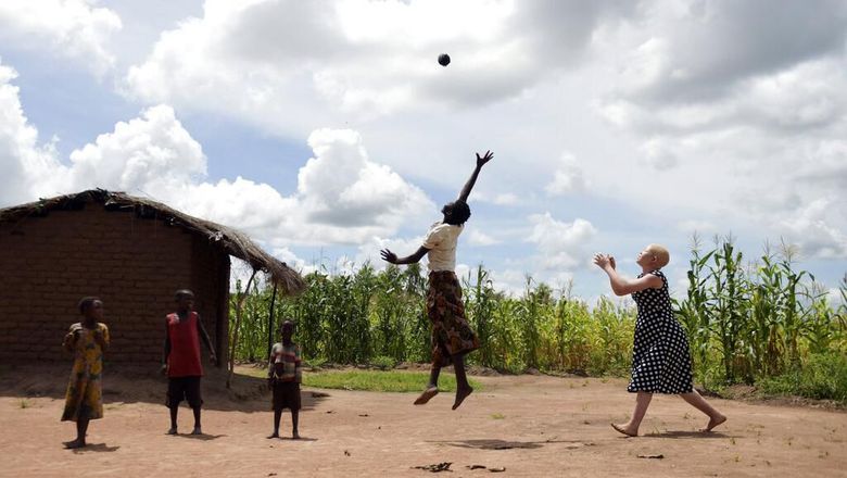 Orang-orang Albino di Malawi Di beberapa negara Afrika orang albino kerap dianggap punya kekuatan magis. Kepercayaan itu membuat orang albino diculik dan diburu demi diambil bagian tubuhnya.