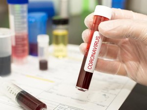 Banyak yang Penasaran Obat Corona, Ini Daftar yang Pernah Diteliti