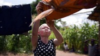 Terlahir sebagai orang albino membuat Catherine kerap dilanda rasa takut kasus percobaan penculikan yang dialaminya pada tahun 2017 silam dapat kembali terulang.