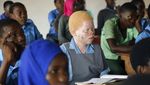 Kehidupan Anak Albino di Afrika yang Selalu Diliputi Kecemasan