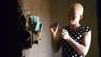 Dilansir dari AP News, Menteri Keuangan Malawi, Joseph Mwanamvekha, mengatakan kepada parlemen pada 21 Februari lalu bahwa sedikitnya ada 5.000 perangkat kemanan menyerupai alarm yang didistribusikan kepada warga albino di kawasan tersebut.