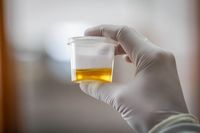 Viral Video ART Campur Urine ke Makanan Majikan, Ini Faktanya!
