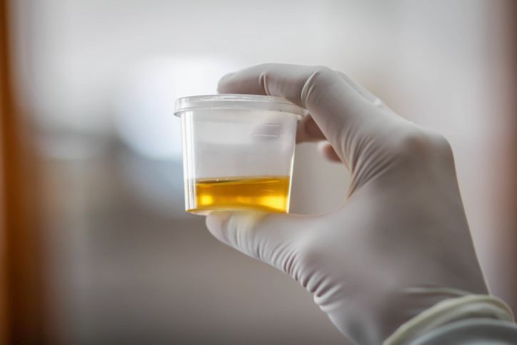 Male hand holding urine sample for drug test. Selective focus on cup.Related Images: