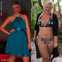 Sekarang Allison Kimmey memakai baju yang lebih besar lima ukuran dari sebelumnya. Meski begitu, Allison telah belajar menerima diri sendiri. Harapan bahwa foto transformasi terbalik ini bisa membuat satu orang menemukan kebahagiannya sekarang, tulisnya. Foto: Instagram @allisonkimmey. Foto: Instagram