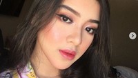 Gadis berusia 18 tahun itu pun menarik perhatian banyak orang termasuk dari kalangan selebriti. Dok. Instagram/tiaraanugrahh