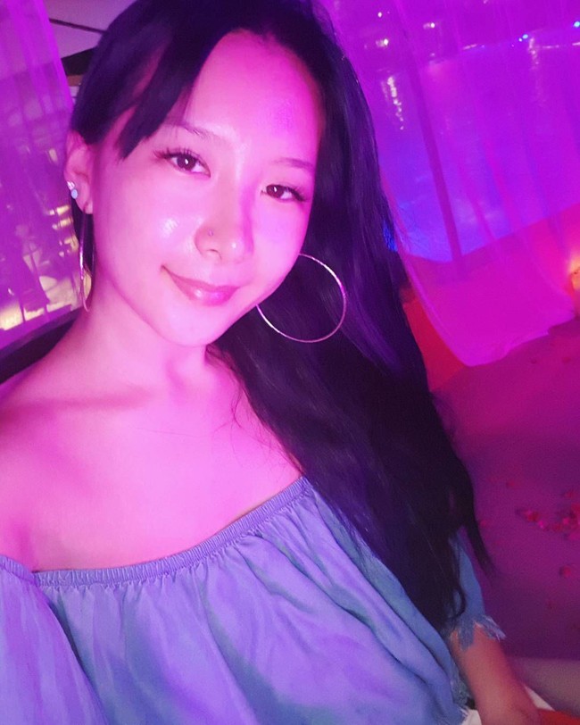 Cheska mengakui dirinya juga menjalani operasi plastik kelopak mata ganda, dan mengungkapkan tak ingin lebih banyak lagi untuk melakukan bedah plastik. Foto: Instagram