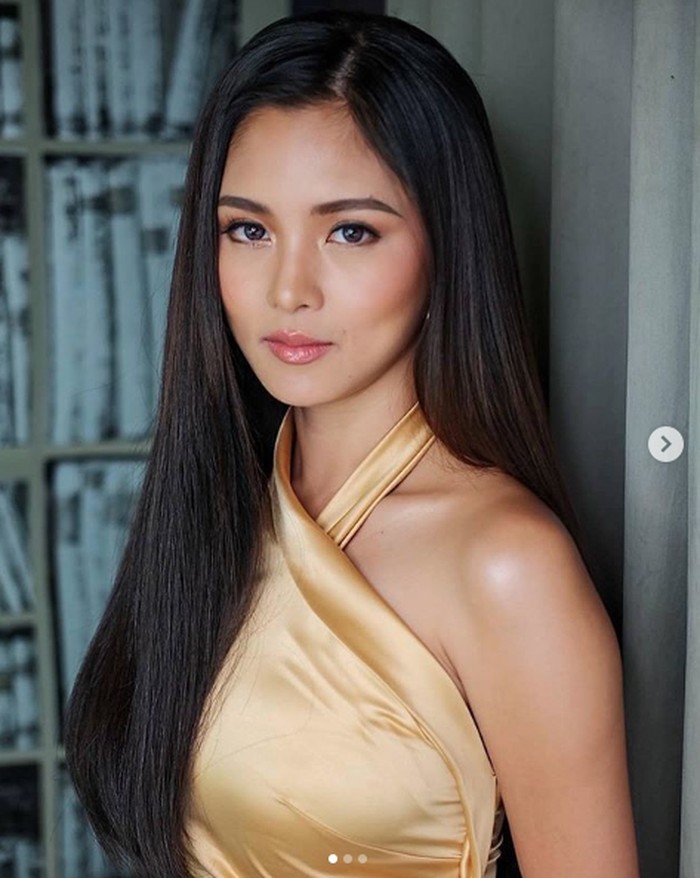 Kim Chiu Kim Chiu, aktris Filipina yang mobilnya dihujani tembakan.