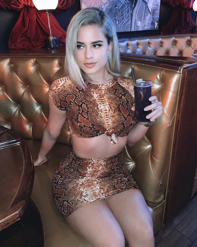 Wanita berusia 22 tahun ini diejek karena kondisi kesehatannya. Yaslen menderita skoliosis yang memengaruhi kelengkungan tulang belakangnya. Ia menjelaskan harus memakai brace setiap hari dan membuat dirinya merasa sangat tidak nyaman. Foto: Instagram