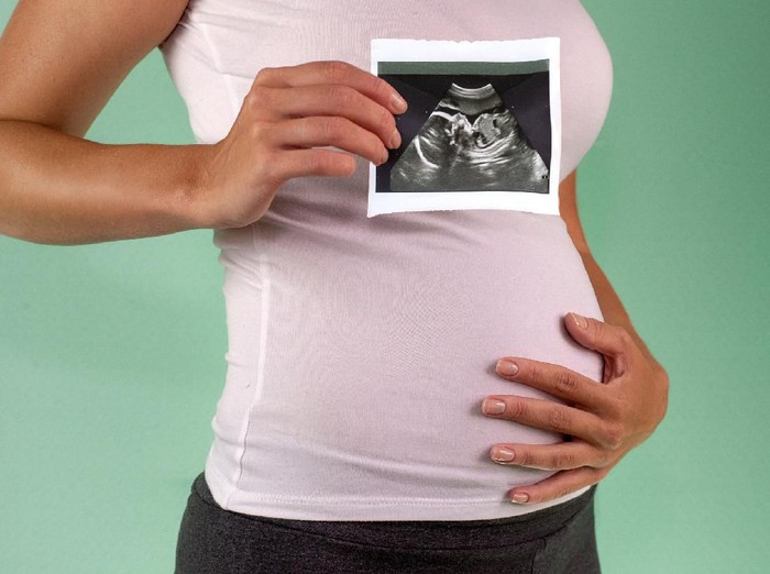 ilustrasi wanita hamil The girl is holding a snapshot of an ultrasound twin in the fourth week of pregnancy. First trimester. Confirmation of pregnancy