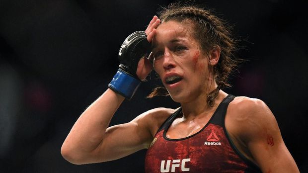 Joanna Jedrzejczyk mengalami pembengkakan hebat usai kalah dari Zhang Weili.