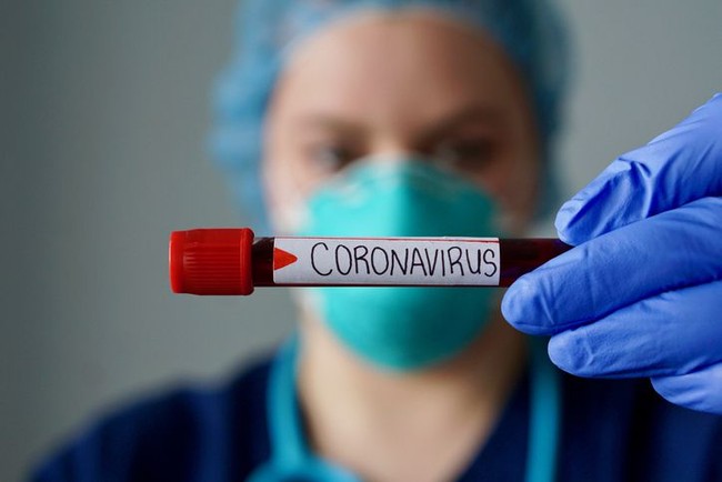 Waspada! Hoax Soal Anjuran Makan dan Minum untuk Cegah Virus Corona