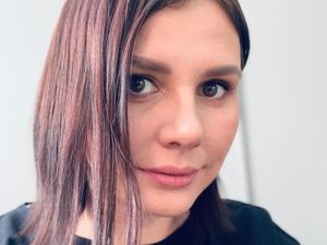 Pacari Anak Tiri, Selebgram Kontroversial Ngaku Oplas untuk Tampil Lebih Muda