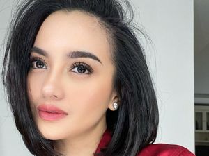 Bukan Alergi Burung, Ririn Ekawati Jelaskan Penyebab Mata Merah dan Bersin Terus