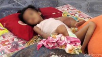 Gadis cilik asal Dusun Kebun Dalam, Desa Bumiayu, Kecamatan Wonomulyo, Kabupaten Polewali Mandar, hidup dalam kondisi memprihatinkan, lantaran menderita tumor ganas.