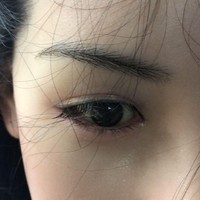 Rambut tidak hanya diimplan di kepala, namun juga di alis dan bulu mata. Foto: dok. Sillicon Lovers