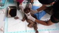 Beberapa pusat rehabilitasi dibangun untuk menyelamatkan orang utan. Dokter-dokter akan merawat luka-luka mereka, seperti pada orang utan yang mengalami patah lengan pada tahun 2019 di Sumatera Utara. (Getty Images)