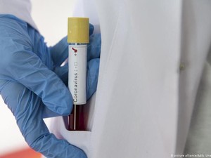 Imunisasi Pasif dari Antibodi Pasien Sembuh Bisa Dipakai Lawan Corona