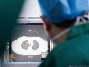 Studi: Pasien yang Pulih dari Corona Bisa Alami Penurunan Fungsi Paru-paru