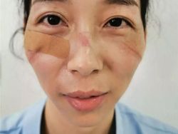 Foto Memilukan Tenaga Medis Sang Pejuang Terdepan Lawan Corona