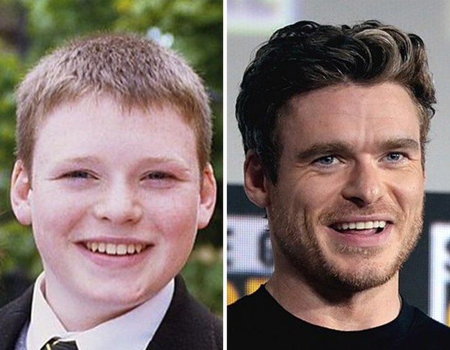 Richard Madden sukses jadi idola setelah penampilannya sebagai Robb Stark di Game of Thrones. Tapi dulu kehidupan remajanya jauh berbeda dari sekarang. Dulu badanku gemuk dan selalu dipermalukan. Aku mulai belajar akting untuk menambah kepercayaan diri, tuturnya, seperti dikutip dari Brightside. Foto: Dok. Brightside/istimewa